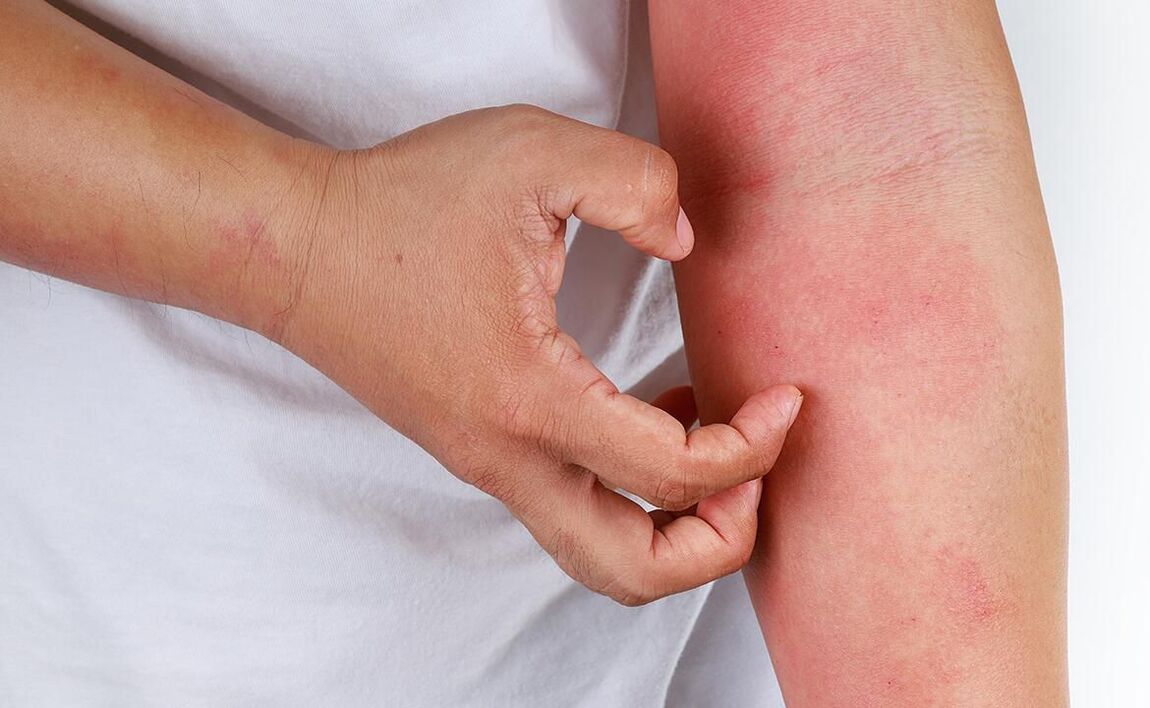 შესაძლო გართულებები სოდის გამოყენებისას